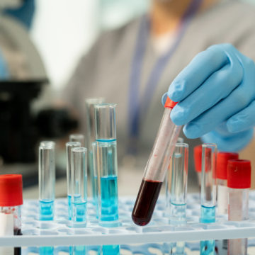 Examining blood sample in laboratory